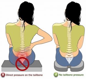 Tailbone Pain Relief With 10 Exercises That You Can Do
